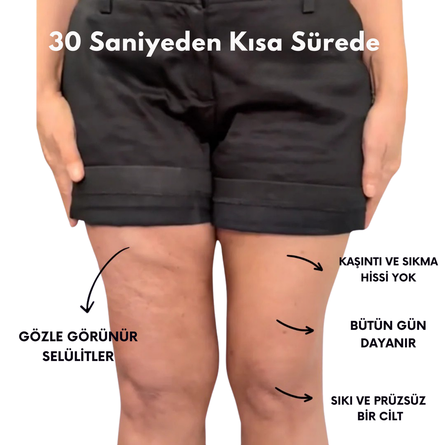 Liftica™ Yeni Nesil Selülit Bandı *3 al 2 öde Kampanyası*
